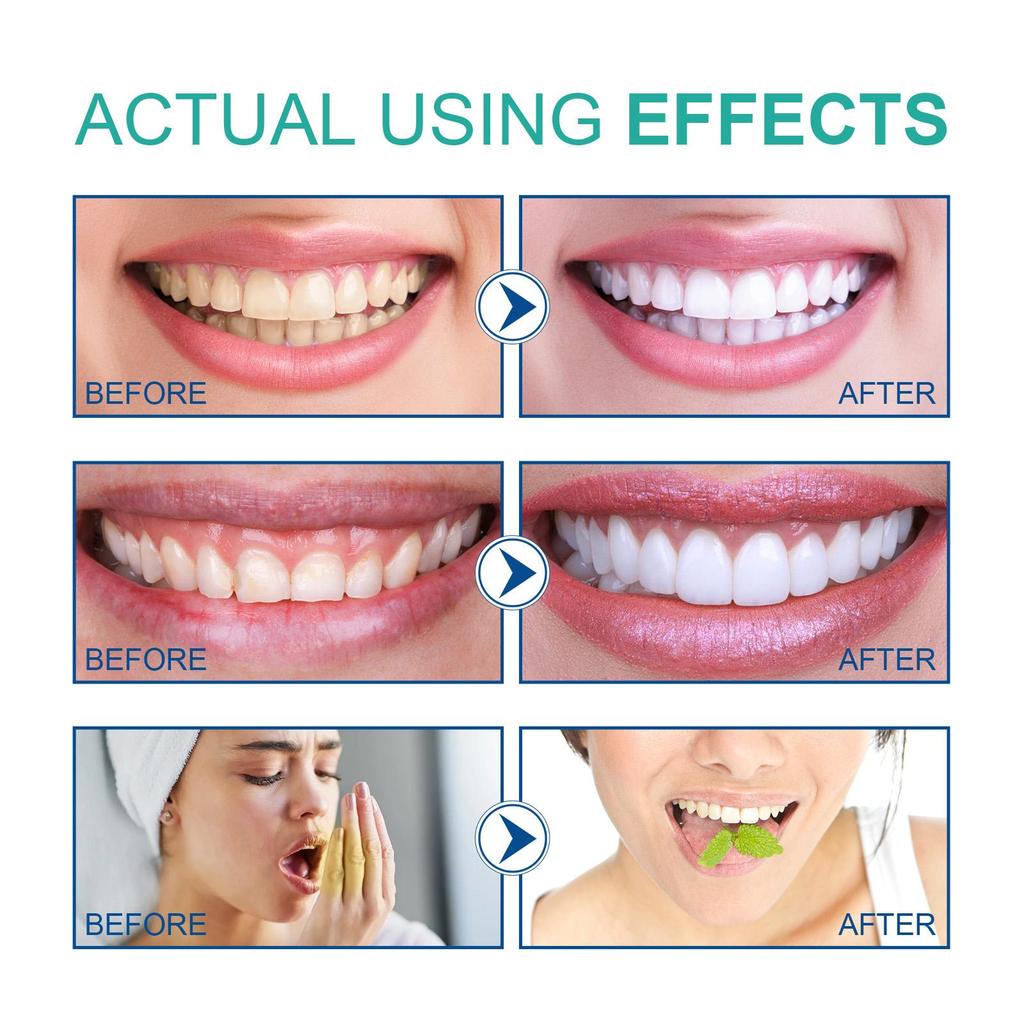 OUHOE Coconut Oil Mouthwash 100ml Remove Tooth Stains Mouth Freshener Protect Your Gums Remove Bad Breath Oral Care Products