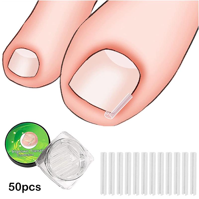 50Pcs Ingrown Toenail Correction Tool Ingrown Toe Nail Treatment Elastic Patch Sticker Straightening Clip Brace Pedicure Tool