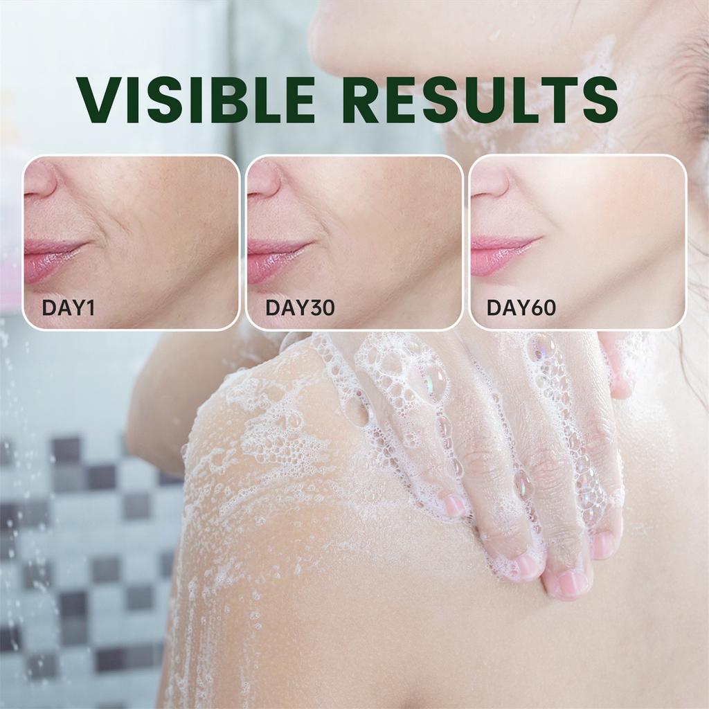 Savon Kojic pour l'hyperpigmentation et les points noirs, savon Kojic anti-points noirs, savon pour le visage, le corps, le bain et les mains, barres de savon nettoyantes pour le visage, 100 g