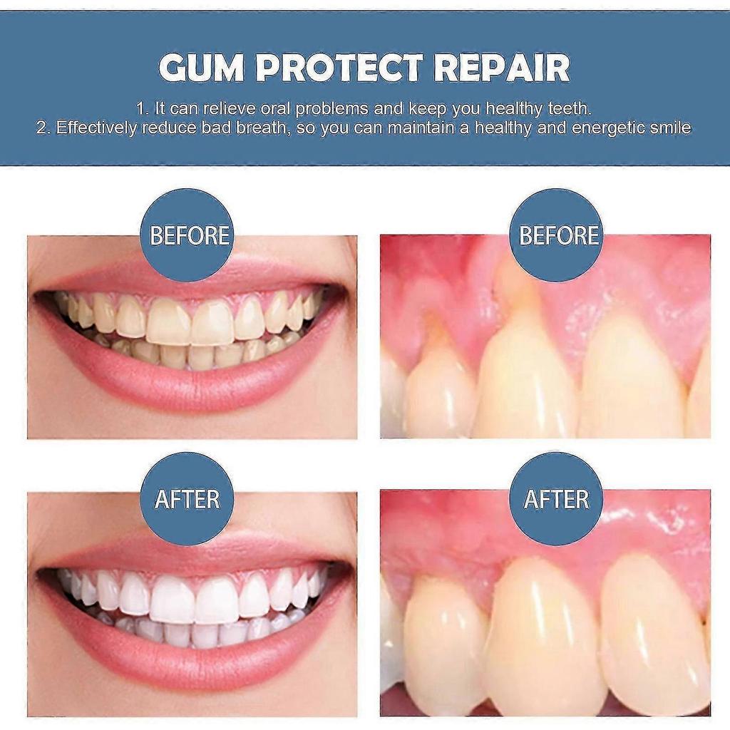 Gum Therapy Gel, Dental Care Gum Regrowth Restore Gum Healthy, Teeth For Removal