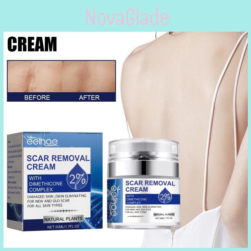 Eelhoe Scar Repair Cream For Reducing Scars And Smoothening Skin With 50ml Capacity