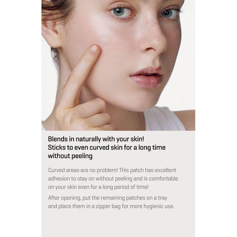 SOME BY MI - Micro Pin Spot Patch