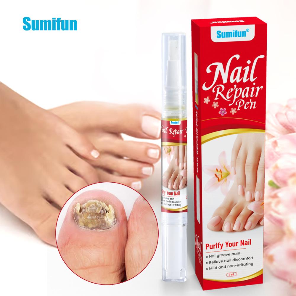 Sumifun 4/8/20 ML Nagelreparatur Flüssigstift Nähren Feuchtigkeitsspenden Graue Nägel Antimykotisch Nagelgesunde Pflege Lösen Mehrere Nagelprobleme