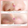 Easily Rcmove Stubborn Blackhcads Deep Cleaning And Blackhead Removal Nasal Mask Charcoal For Women's Nose Patches 1 Box  6 Pieces