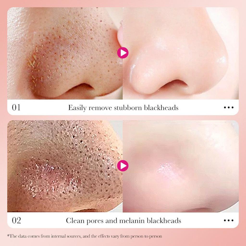 Easily Rcmove Stubborn Blackhcads Deep Cleaning And Blackhead Removal Nasal Mask Charcoal For Women's Nose Patches 1 Box  6 Pieces