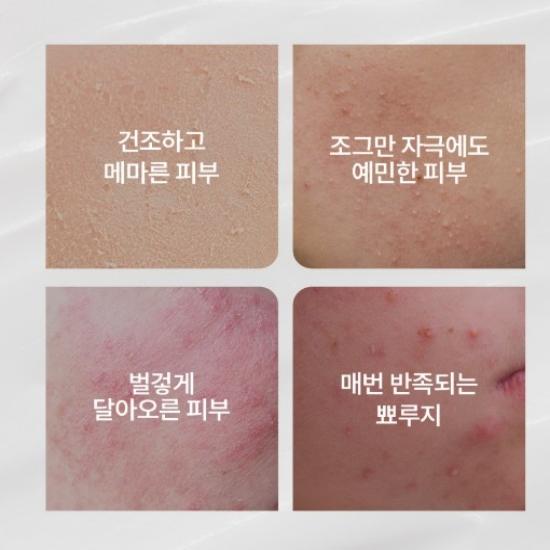 [Ilyang Pharmaceutical] Dr. Primetic Wrinkle Whitening Cream Sensitive Skin Dark Spot Brightening Cream
