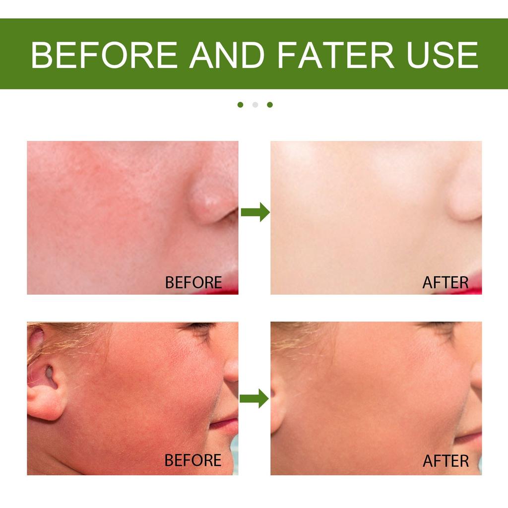 Aloe Veras Gel Hydrating Moisturizing Relief After Sun Care Facial Skin Care Aloe Veras Gel