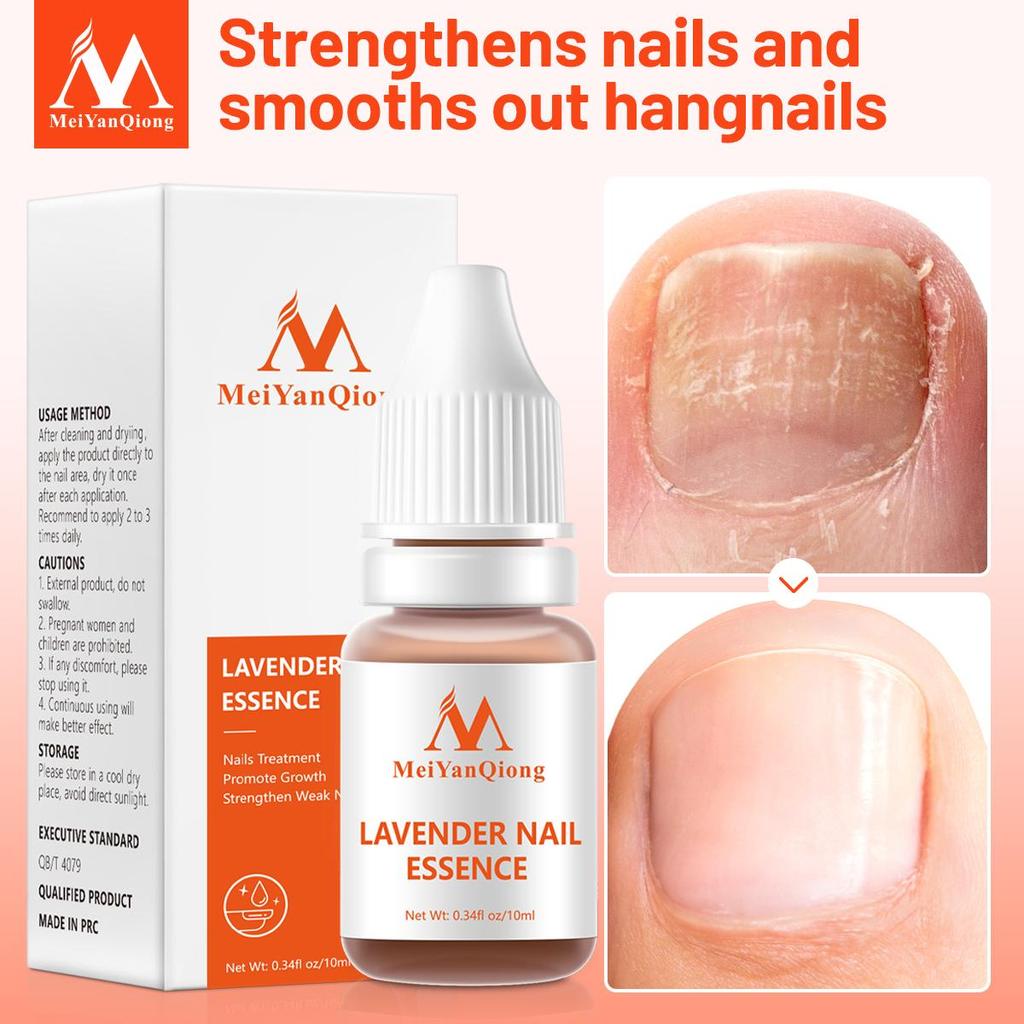 MeiYanQiong Tratament de reparare a unghiilor Ulei esențial pentru unghii de lavandă Nail Art & Tools Tratament sănătos pentru unghii Îngrijirea picioarelor