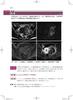 Imaging Diagnosis of Gynecological Diseases Learned from Case Studies