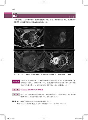 Imaging Diagnosis of Gynecological Diseases Learned from Case Studies