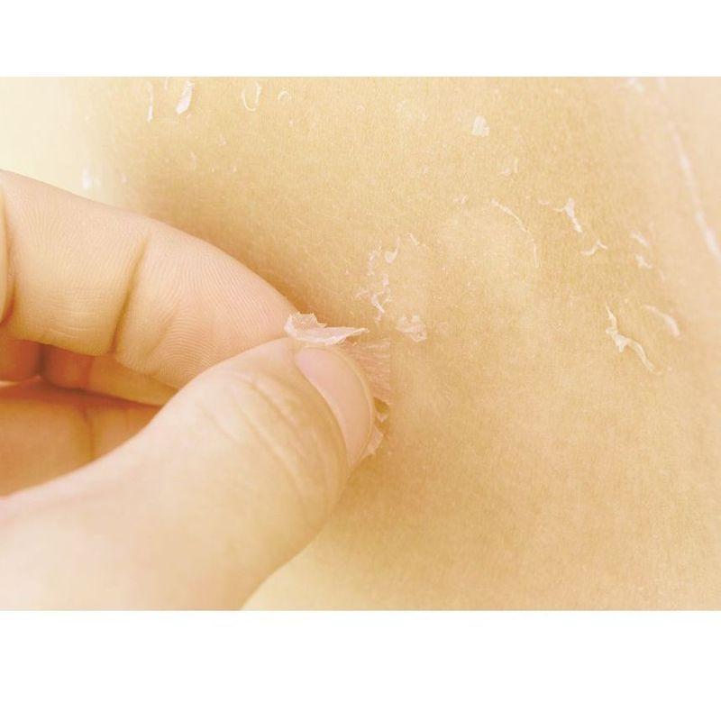 Ottie - Calendula LHA Mild Peeling Gel