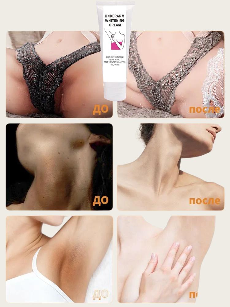 Crema Corpo Bellezza Crema Sbiancante Ascelle Tra Le Gambe Ginocchia Parti Intime Sbiancamento Ascella