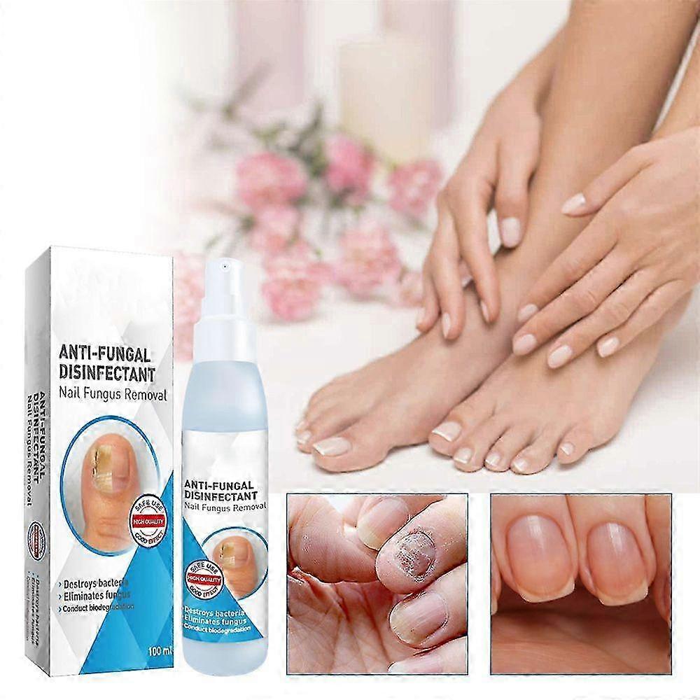 3pcs Nail Repair Spray 100ml, Repair Soften Thicken Nails, Clean Polish Nails, Professional Nail Care Treatment