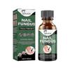 Extra Strong Nail Fungus Treatment, Best Nail Repair Solution To Stop Fungal Growth Effectively for Toenails and Fingernails