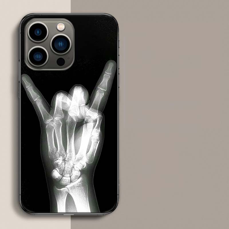 Herbst Röntgen Handknochen Handyhülle Für Apple Iphone 16E 16 17 Pro Max Air 15 Pro 14 Plus 12 13 Mini Hülle Niedliche Fundas Silico