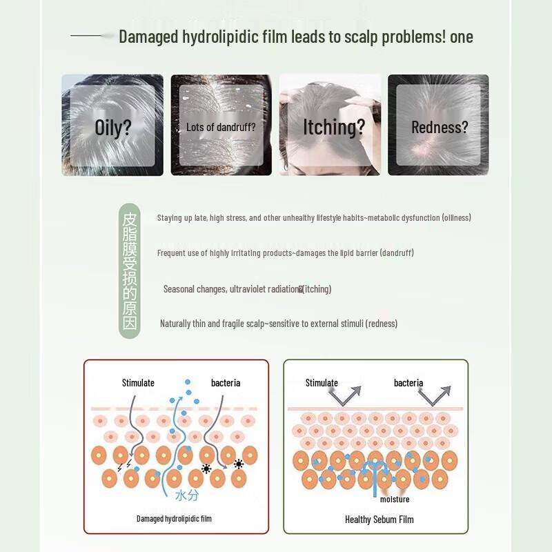 Shulei Anti-Dandruff & Oil Control Shampoo
