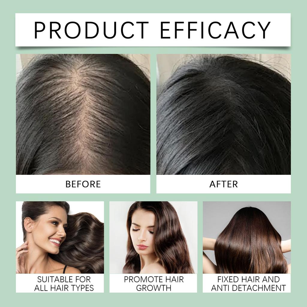 Šampon pro růst vlasů hloubkově čistí, snižuje nepohodlí, hydratuje pokožku hlavy a zmírňuje suchost a svědění, 100 ml