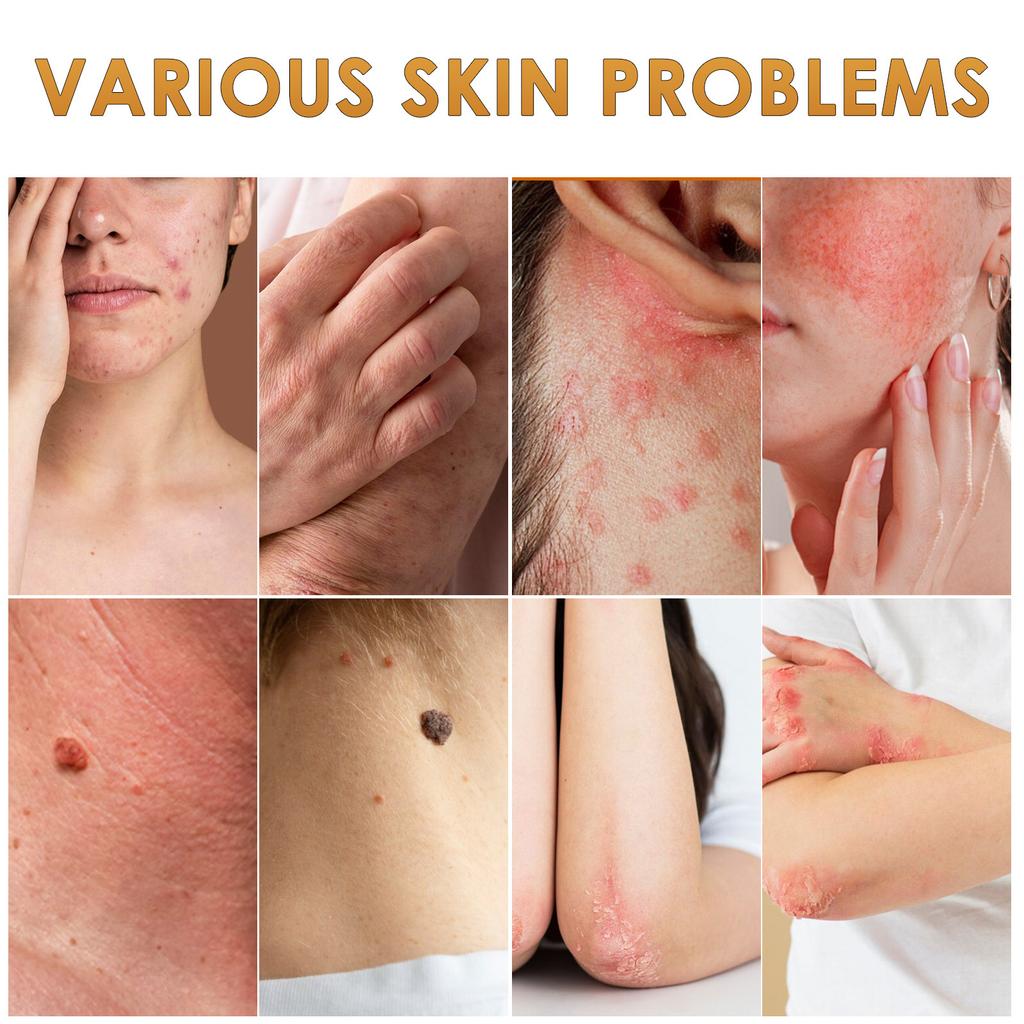 Krem do Skóry Odżywczy Krem do Pielęgnacji Skóry Etykiety Skórne I Poprawia Niedoskonałości. Nadaje się do wszystkich rodzajów skóry