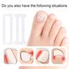 10 Pieces Ingrown Toenail Correction Kit Flexible Toenail Strips Toenail Straightener Thick Toenail Recovery for Adults