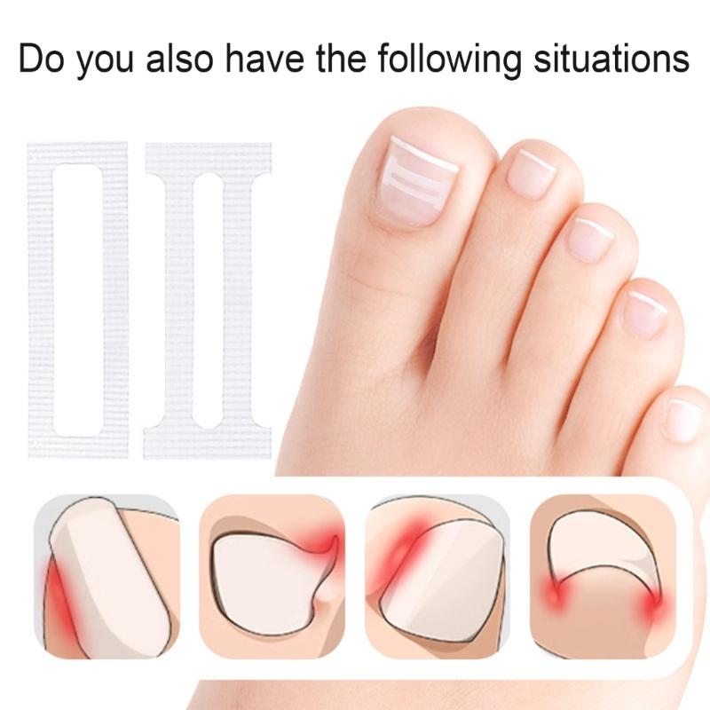 10 Pieces Ingrown Toenail Correction Kit Flexible Toenail Strips Toenail Straightener Thick Toenail Recovery for Adults