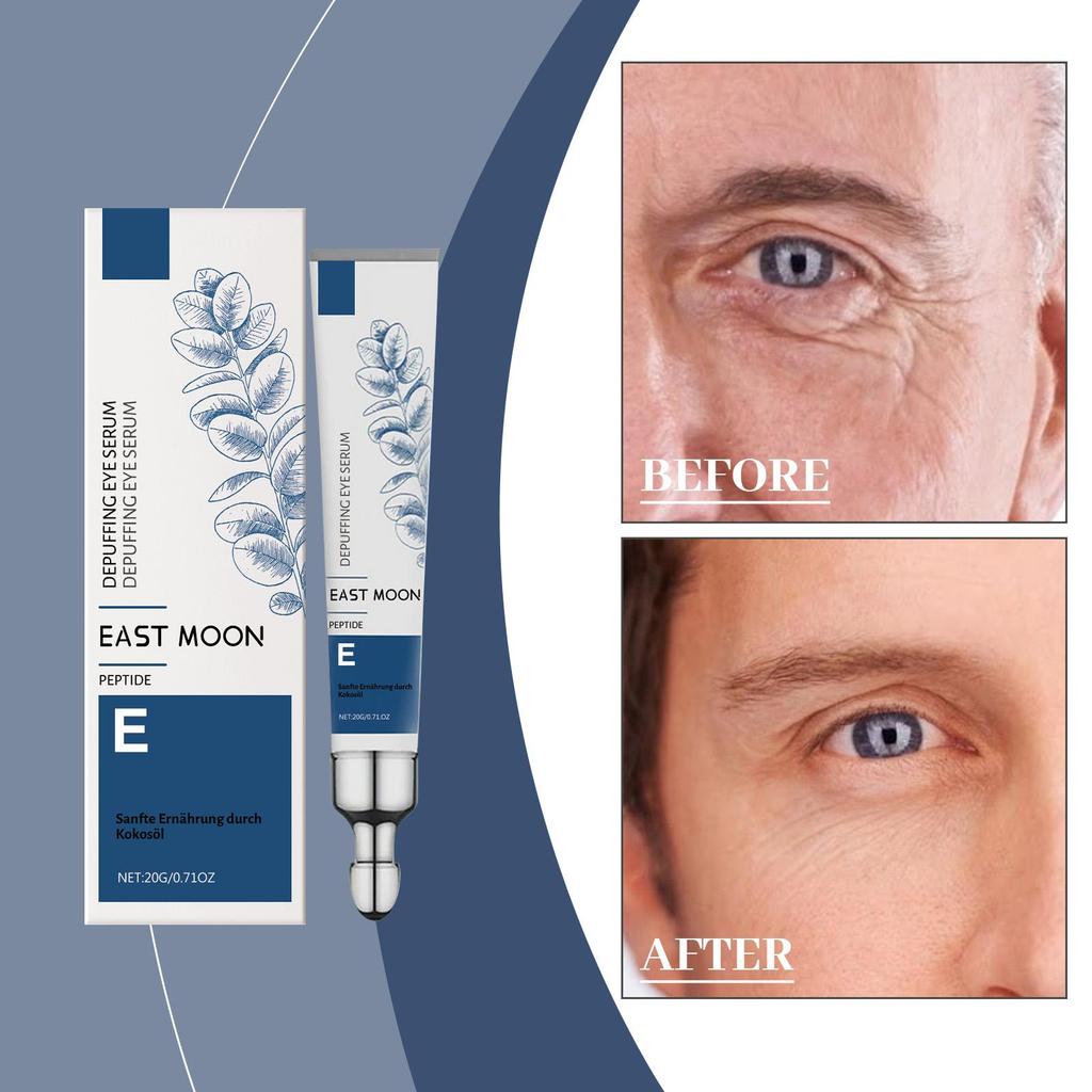 East Moon Moisturizing Men's Eye Cream Fades Fine Lines Of Eye Improves Puffiness Brightens And Tightens Eye Weeks