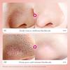 Sadoer 6Pcs Bamboo Charcoal Clean Nose Patches Face Cleansing Quickly Remove Blackheads Comedones Shrink Pore Skin Care Mask