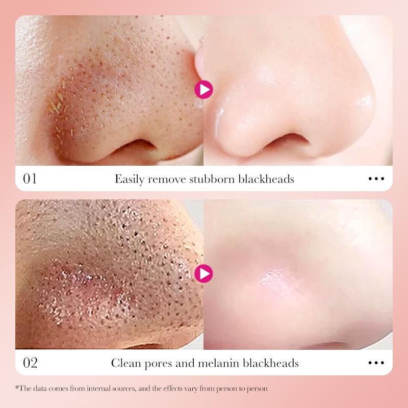 Sadoer 6Pcs Bamboo Charcoal Clean Nose Patches Face Cleansing Quickly Remove Blackheads Comedones Shrink Pore Skin Care Mask