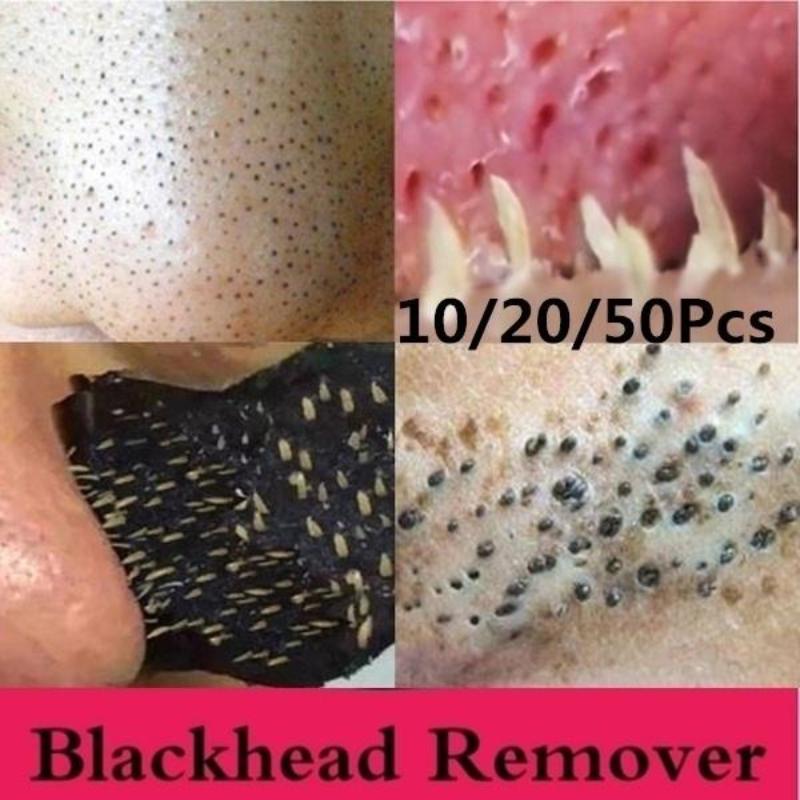 10/20/50Pcs Nose Blackhead Acne Deep Clean Removal Pore Cleansing Cleaner Nose Membranes Strips