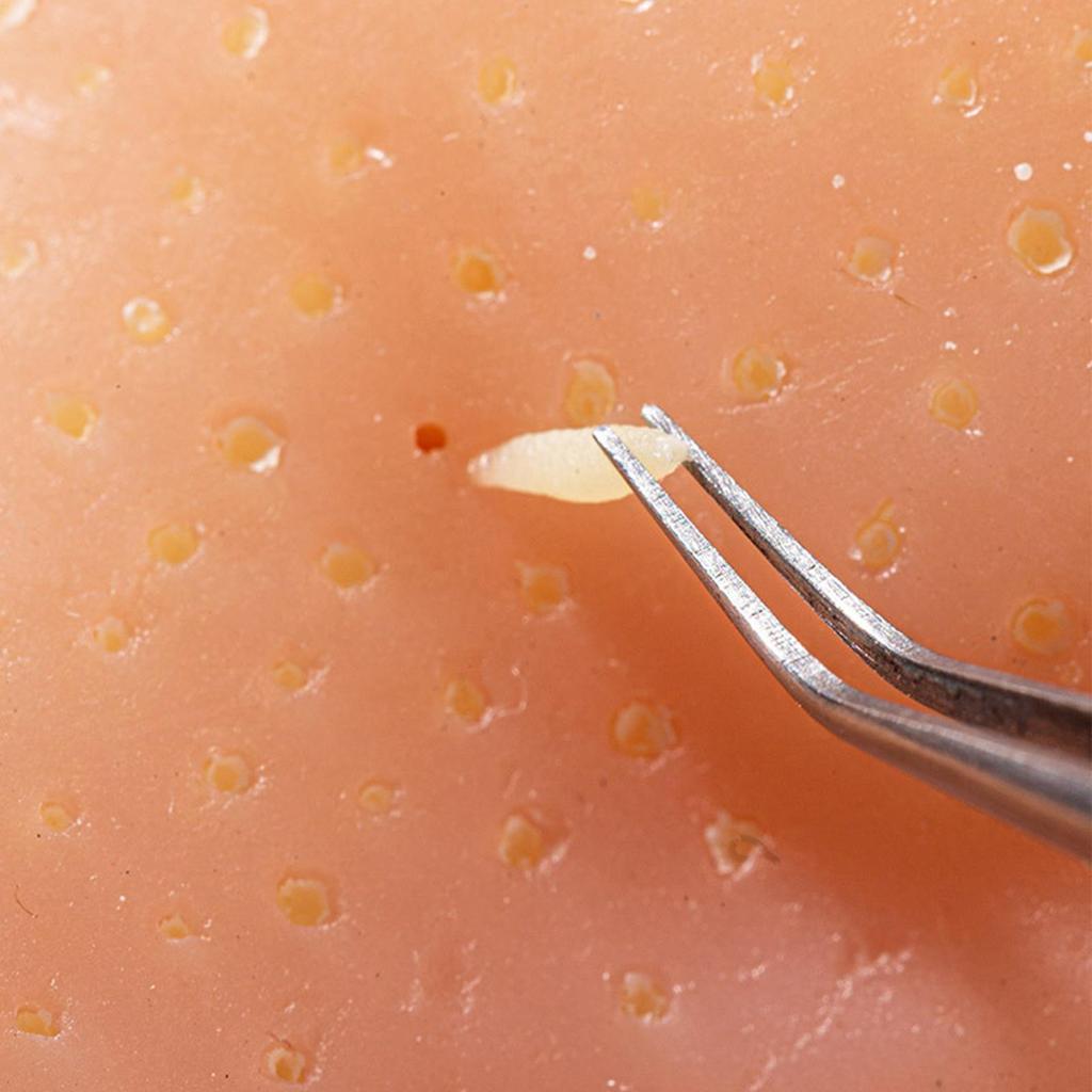 Pimple Popper Toy Silicone Stress Relief Fidget Sensory Toys for Anxiety Reusable Squeeze Sensory Pad for Adults Kids Xmas Gifts