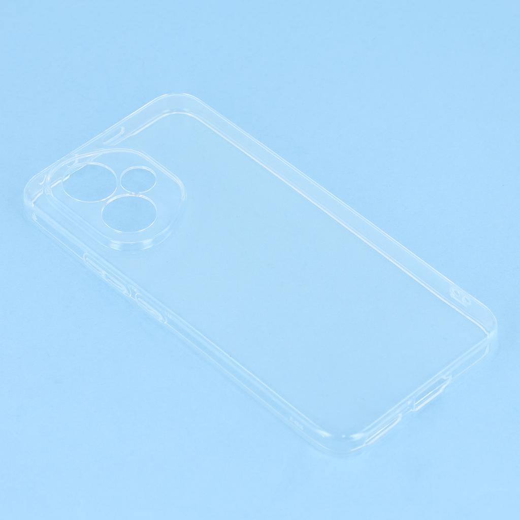 UNITHIN For Honor 400 5G (Global) Case Ultra Thin 0.7mm Clear TPU Anti Drop Phone Cover Precise Cutouts