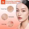 MeiYanQiong Centella Acne Patch Stickers Acne Treatment Pimple Remover Tool Blemish Spot Facial Mask Skin Care Waterproof 24 Patches