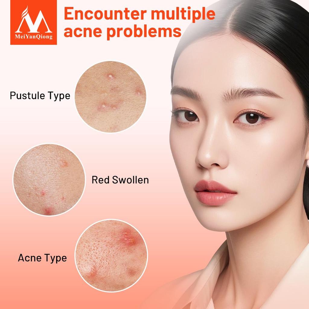 MeiYanQiong Centella Acne Patch Stickers Acne Treatment Pimple Remover Tool Blemish Spot Facial Mask Skin Care Waterproof 24 Patches