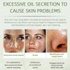 Crème anti-acné pour le visage, élimine les pores dilatés, traite l'acné, contrôle du sébum, réduit les pores, crème pour le visage, soins de la peau, beauté et santé