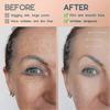 Face Lift Tape Anti Wrinkle Face Eye Neck Lift Tape With Medical Grade Adhesive For Firming And Tightening Skin Instant Effect
