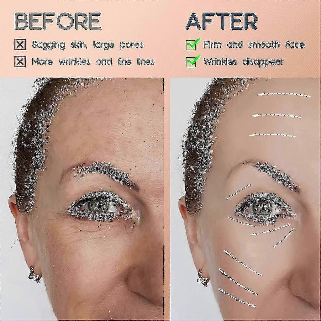 Face Lift Tape Anti Wrinkle Face Eye Neck Lift Tape With Medical Grade Adhesive For Firming And Tightening Skin Instant Effect