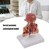 Human Pathologies of Rectum Model Human Rectum Model Human Anatomical Model Easy to Use Medicals Teaching Aid