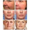 Retinol-Gesichtscreme, straffend, Lifting, Anti-Aging, feine Linien, aufhellend, aufhellend, feuchtigkeitsspendend, Gesichtspflege, 20 g