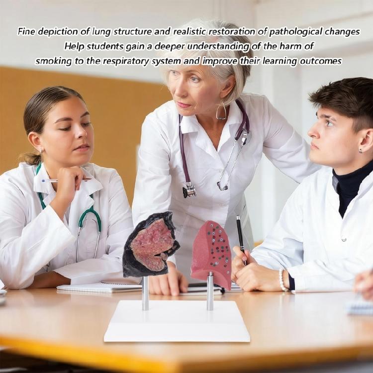 Anatomically Accurate Smoker Lung Comparison Model With Healthy Lung PVC Substance For Clinical Education