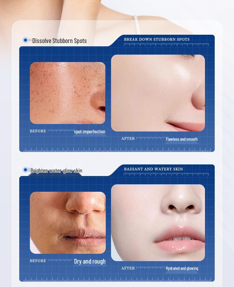 Whitening Spot Removal Cream with Niacinamide - Brightening & Hydrating Skincare for Autumn/Winter