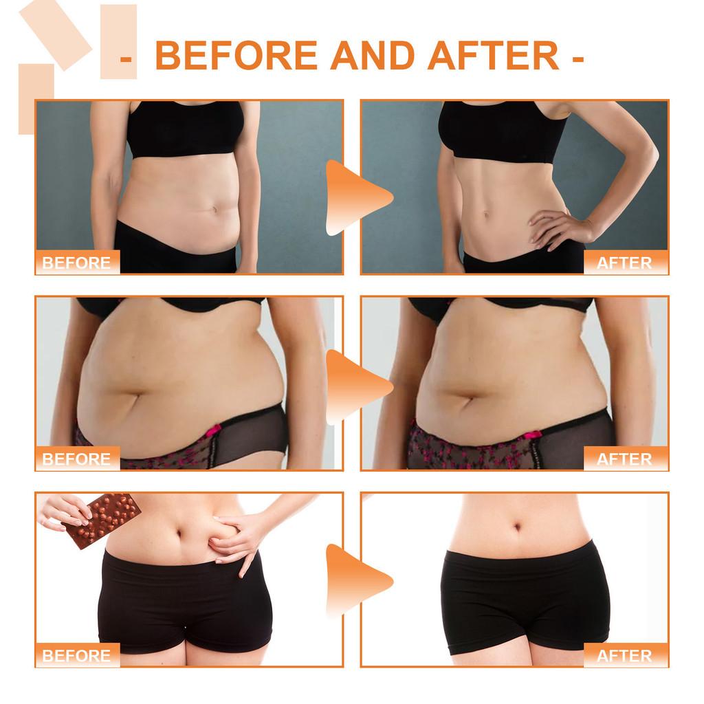 South Moon Body Shaping Patches Firming Skin For Arms Reducing Flabby Flesh 20 Pieces