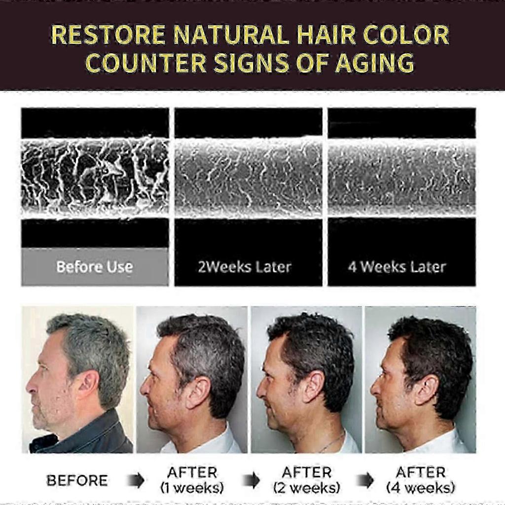 Shampoo,hair Dye Shampoo 3 In1 For Gray Hair, Herbal Black Hair Dye Shampoo For Men Grey Coverage (black) - Hz