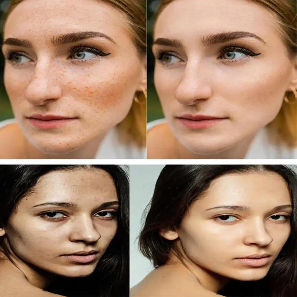 Anti-aging Cream, Rich In Collagen, Prevents Dry Lines, Moisturizes and Moisturizes, Effective Whitening and Freckle Removal Cream