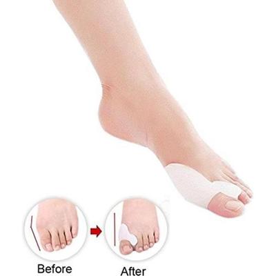 Dr.Pedi Gel Toe Bunion Correcteur SšŠparateurs Hallux Valgus Pro Toe Stretchers Bunion Straightener Alignement (1 Paire): Beauté