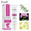 Acne Remover Cream Skin Repair Face Cream Acne Spots Acne Treatment Blackhead Whitening Cream Skin Care