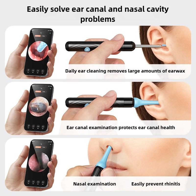 Smart Ear Wax Removal Tool With Camera Wireless Ear Cleaner and Check for Adult Kids Safe Ear Canal Cleaning Kit