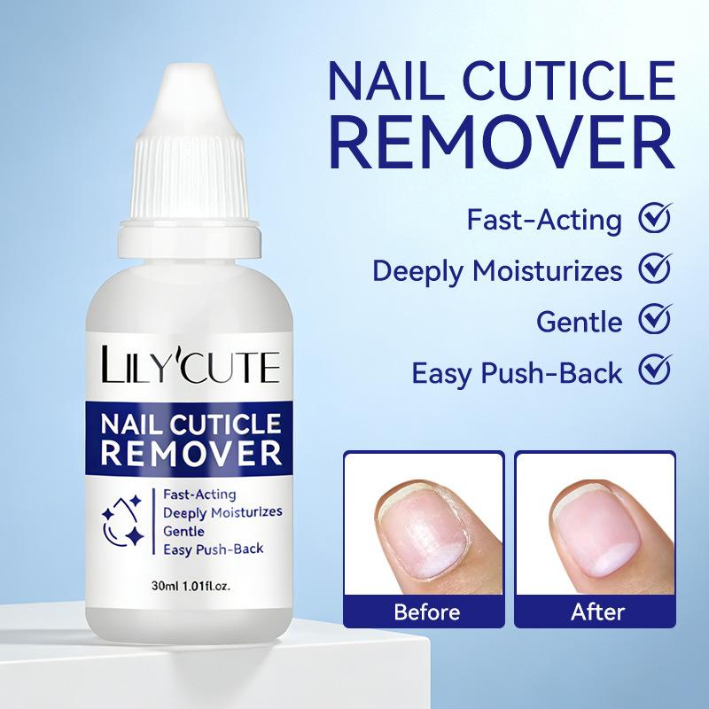 30ml Nail Cuticle Remover Gel Professional for Dead Skin Care Fast Softening Gel for Manicure Home Salon