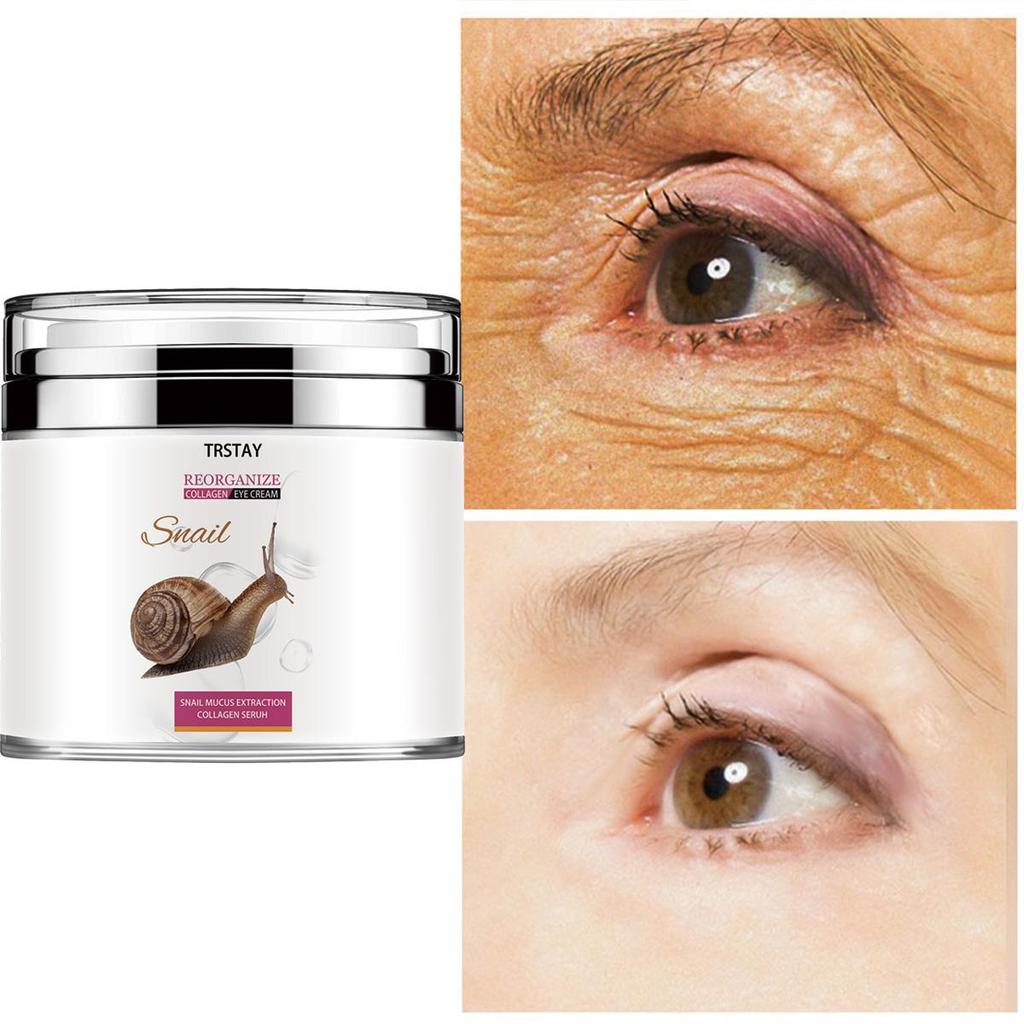 Eye cream, tightening crow's feet, moisturizing, fine lines, massage, massage eye cream around the eyes