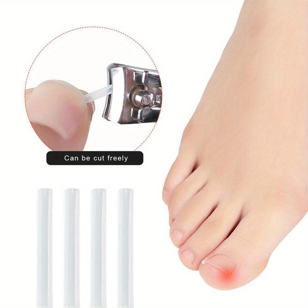 10Pcs Toenail Straightening Clippers Toenail Correction Tools Set Nail Care Elastic Stickers Pedicure Foot Care Tools