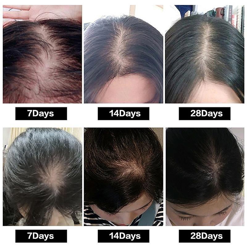 Liquide de soin hydratant pour la croissance des cheveux Favorise la croissance des cheveux, prévient la chute des cheveux, épaissit les cheveux Huile essentielle de soin