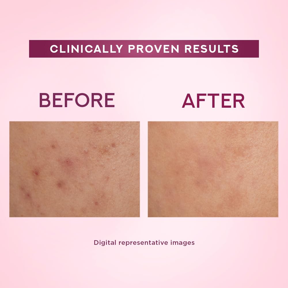 Pond's Bright Beauty Light Cream with UV Filter | Niasorcinol | 50g